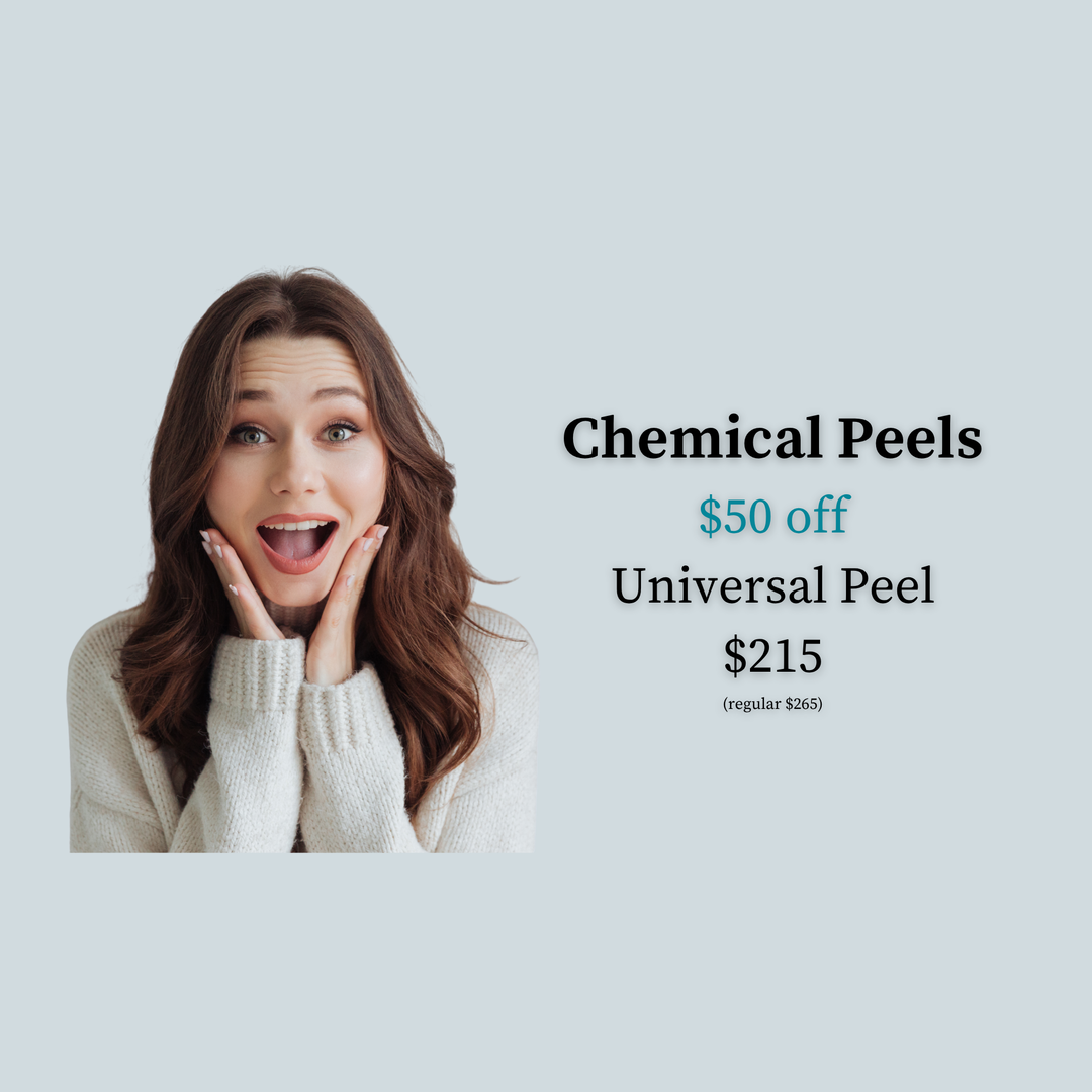 Universal Peel Special: $50 off Universal Peel