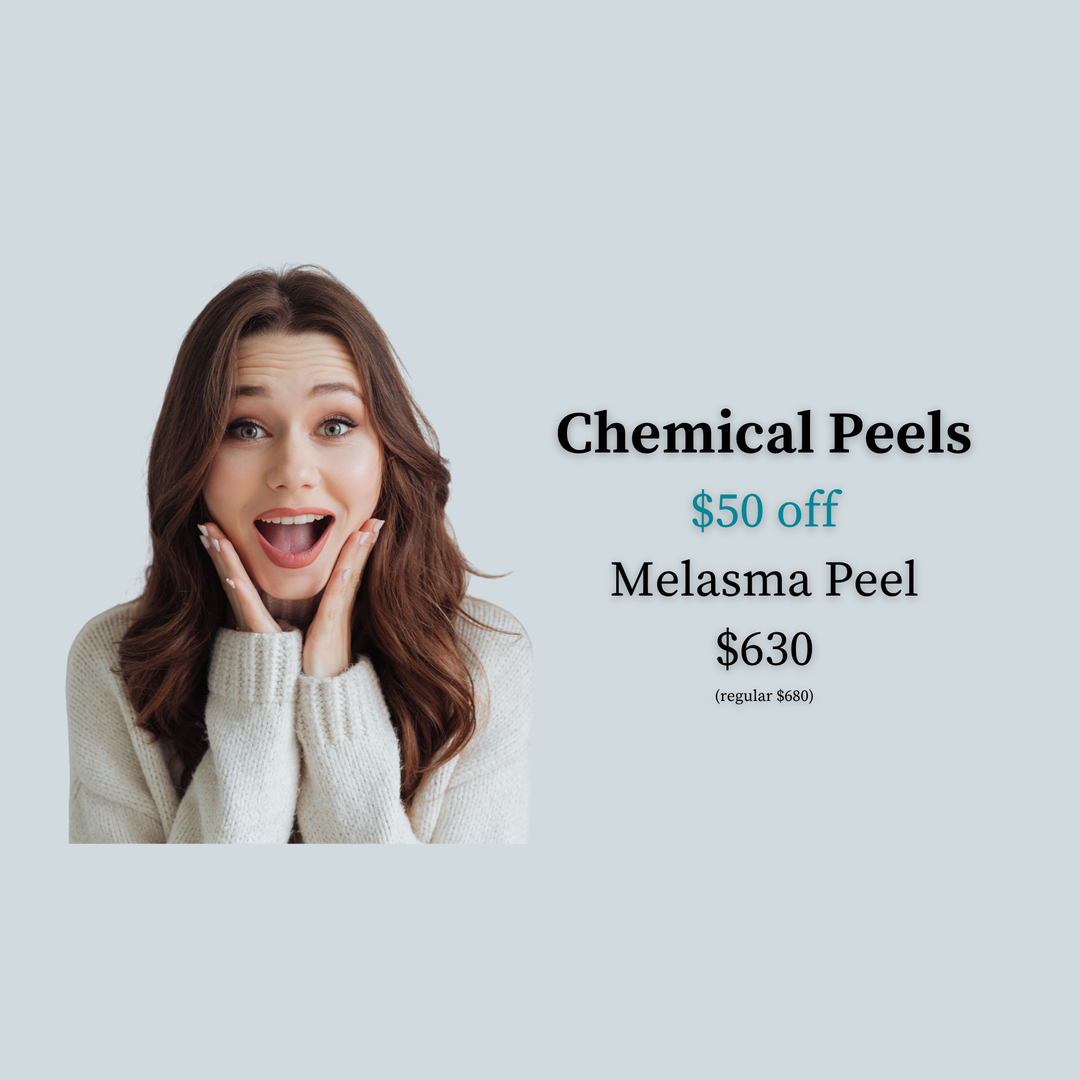 Melasma Peel Special: $50 off Melasma Peel